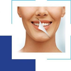 Safely Achieve a Whiter Smile with These Teeth Whitening Tips